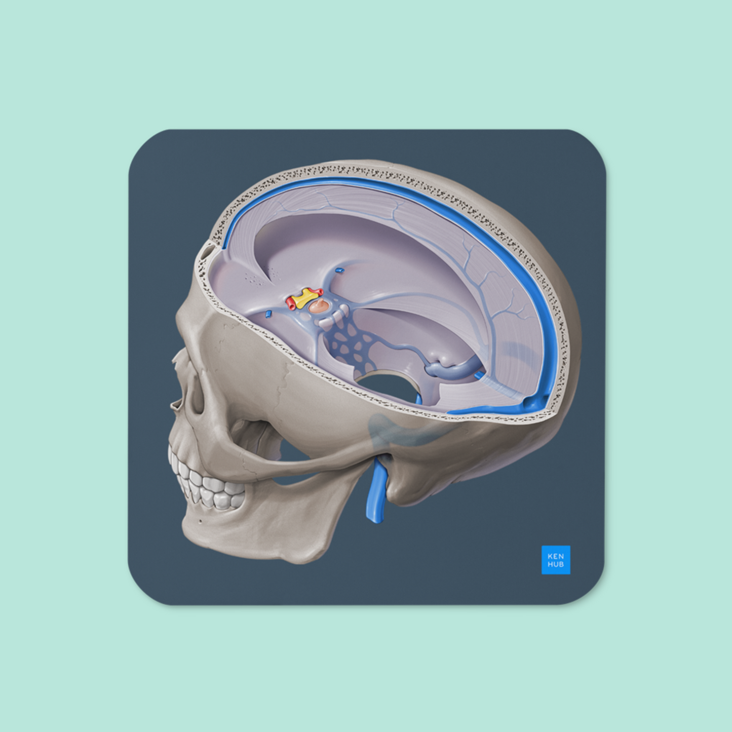 Dural Venous Sinuses - Cork-back coaster