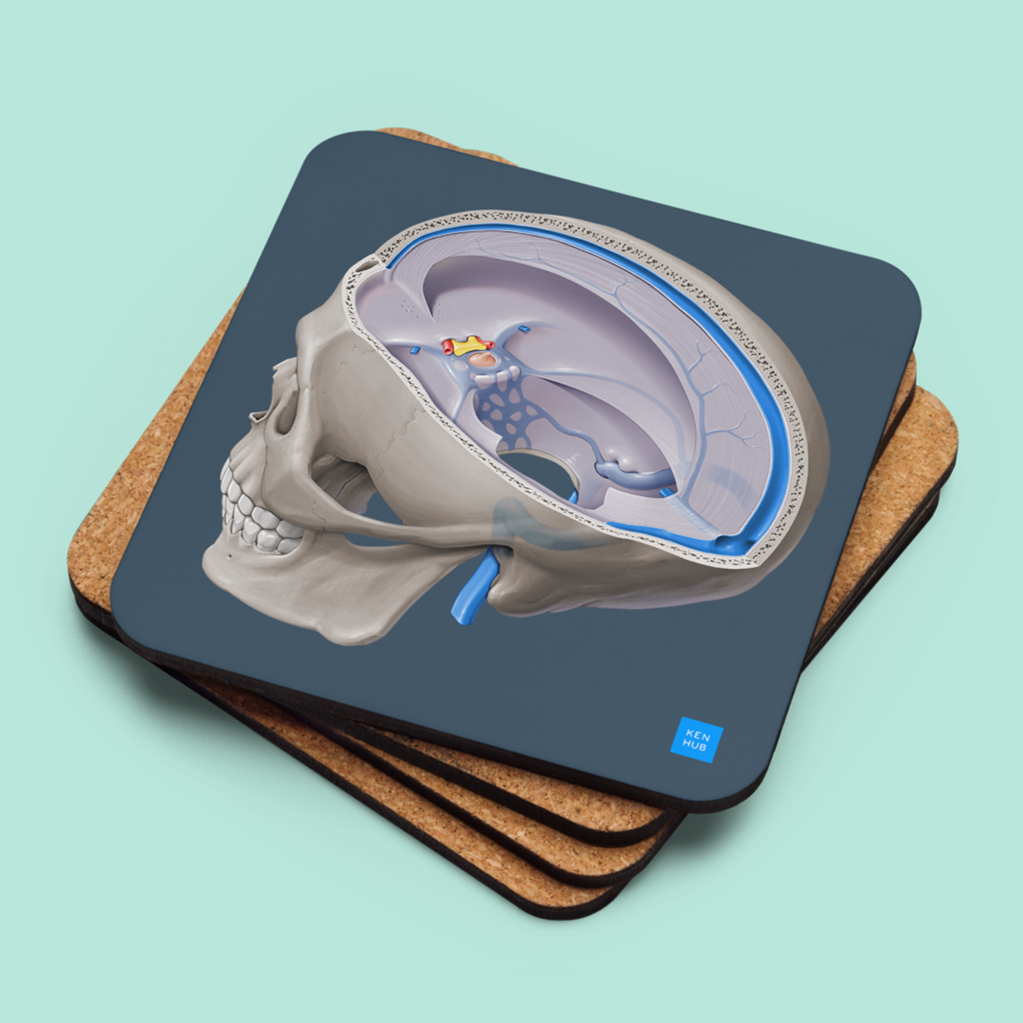 Dural Venous Sinuses - Cork-back coaster