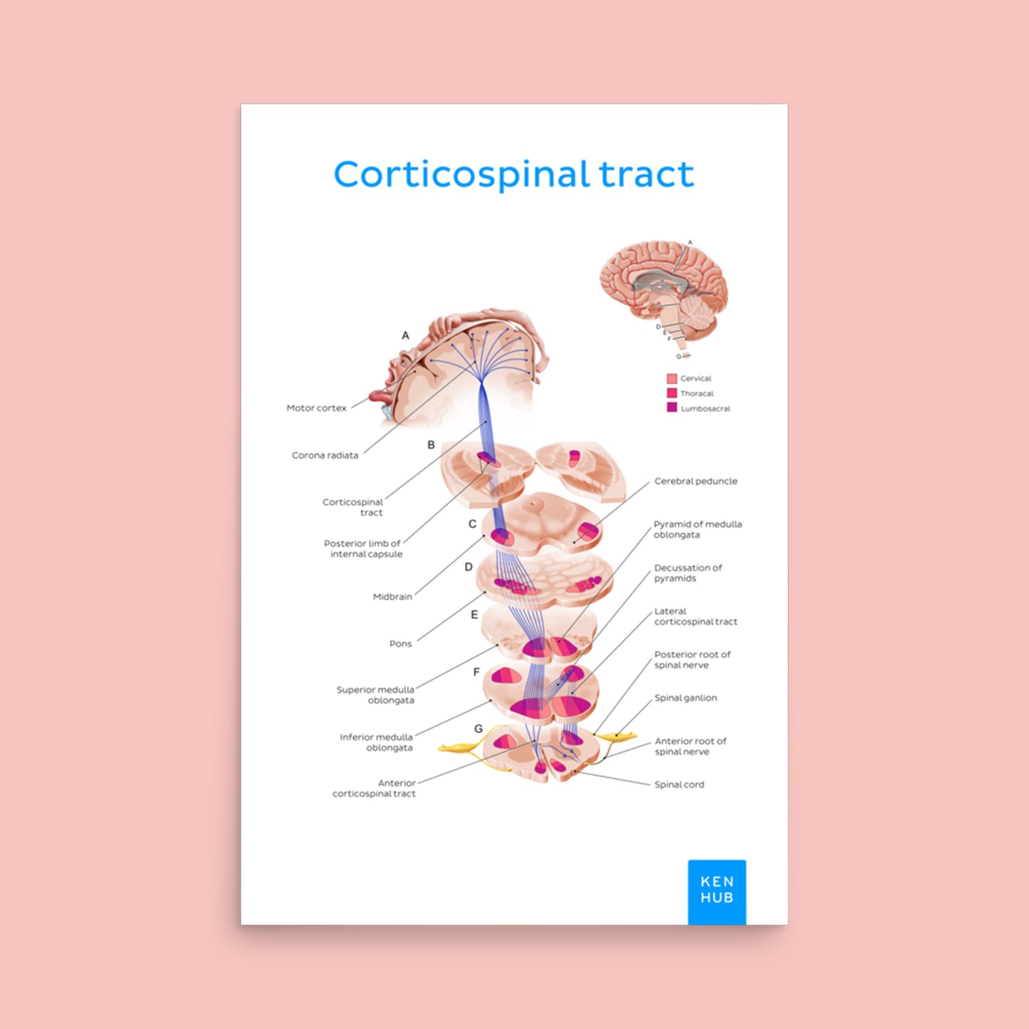 Corticospinal Tract - Poster